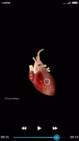 Cardiology-Animated Dictionary Screenshot 2