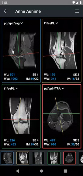 IDV - IMAIOS DICOM Viewer Ekran Görüntüsü 2