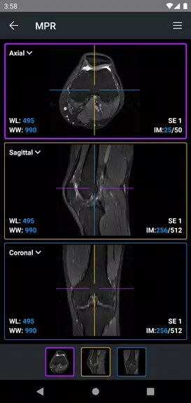 IDV - IMAIOS DICOM Viewer Tangkapan skrin 3